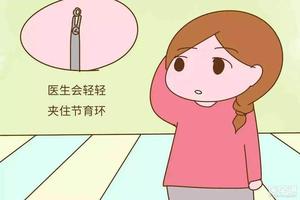 永康女人取环过程(为什么不建议女人上环)