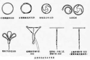 永康上环是什么原环(现在最新上环是什么环)