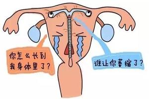 永康女性取环手术(取环手术全过程视频)