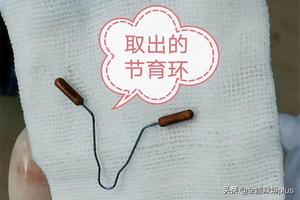 阿图什上环环用一般多少钱(女人上环上什么环最好)