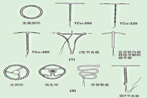 莎车计生上环(计生办上环要什么手续)